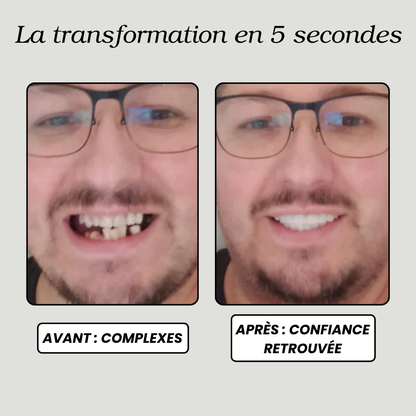 Facettes Dentaires Clip-On