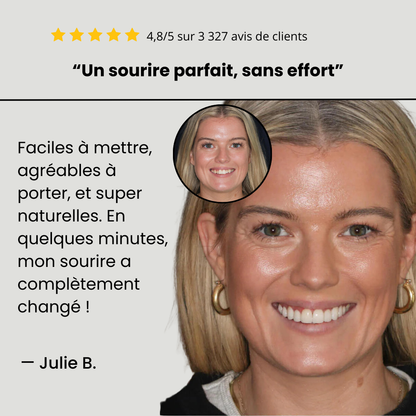 Facettes Dentaires Clip-On